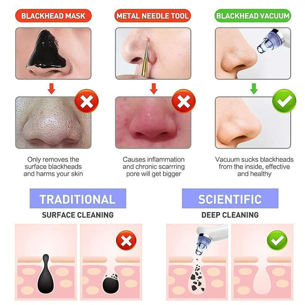Vacuum Suction Tool With 4 Suction Head For Men And Women (Multi-color  1 Set) (Usb  Adapter Included)